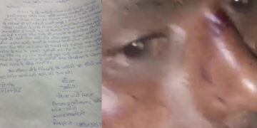 मामा के बेटी दामाद सहित अन्य बेटियों ने किया हमला, मामा का भांजा लहूलुहान