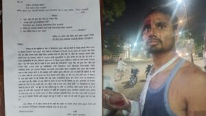 रायबरेली में युवक पर जानलेवा हमला, लोहे की रॉड से पीटकर किया लहूलुहान